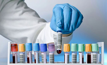 Detectan ocho tipos de cáncer a través de un test de sangre 